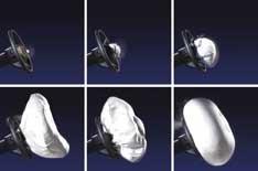 3.4m Japanese cars recalled over airbags